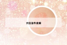 穴位治牛皮癬