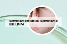 淄博哪家醫(yī)院皮膚科比較好 淄博哪家醫(yī)院皮膚科比較好點