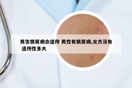 男生銀屑病會遺傳 男性有銀屑病,女方?jīng)]有 遺傳性多大