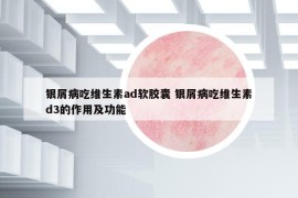 銀屑病吃維生素ad軟膠囊 銀屑病吃維生素d3的作用及功能