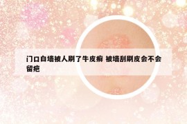 門口白墻被人刷了牛皮癬 被墻刮刷皮會(huì)不會(huì)留疤