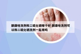 酮康唑洗劑和二硫化硒哪個(gè)好 酮康唑洗劑可以和二硫化硒洗劑一起用嗎