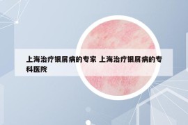 上海治療銀屑病的專家 上海治療銀屑病的?？漆t(yī)院