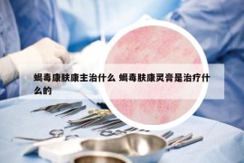 蝎毒康膚康主治什么 蝎毒膚康靈膏是治療什么的