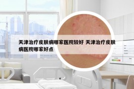 天津治療皮膚病哪家醫(yī)院較好 天津治療皮膚病醫(yī)院哪家好點(diǎn)