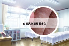 白癜風(fēng)恢復(fù)期要多久