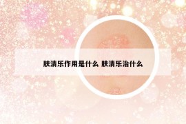 膚清樂作用是什么 膚清樂治什么