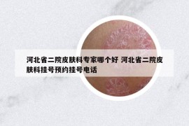 河北省二院皮膚科專家哪個好 河北省二院皮膚科掛號預約掛號電話