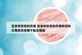 百多邦軟膏的作用 百多邦軟膏的作用和功效紅霉素軟膏哪個能去痘痘