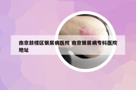 南京鼓樓區(qū)銀屑病醫(yī)院 南京銀屑病?？漆t(yī)院地址