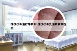 桂枝茯苓治療牛皮癬 桂枝茯苓丸治皮膚病醫(yī)案