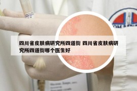 四川省皮膚病研究所四道街 四川省皮膚病研究所四道街哪個(gè)醫(yī)生好