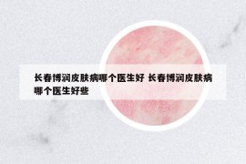 長(zhǎng)春博潤(rùn)皮膚病哪個(gè)醫(yī)生好 長(zhǎng)春博潤(rùn)皮膚病哪個(gè)醫(yī)生好些