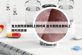 吉大附院皮膚科上班時(shí)間 吉大附院皮膚科上班時(shí)間安排