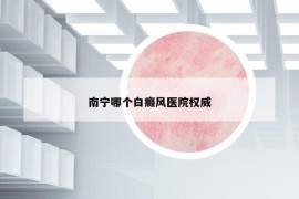 南寧哪個(gè)白癜風(fēng)醫(yī)院權(quán)威