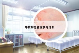 牛皮癬患者應(yīng)多吃什么