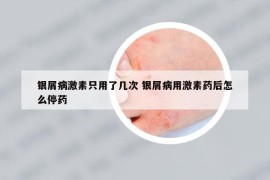 銀屑病激素只用了幾次 銀屑病用激素藥后怎么停藥