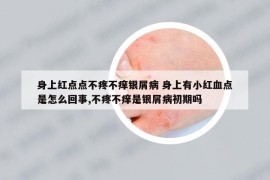 身上紅點(diǎn)點(diǎn)不疼不癢銀屑病 身上有小紅血點(diǎn)是怎么回事,不疼不癢是銀屑病初期嗎
