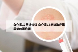 白介素17單抗價(jià)格 白介素17單抗治療銀屑病的副作用