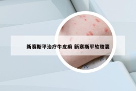新賽斯平治療牛皮癬 新塞斯平軟膠囊