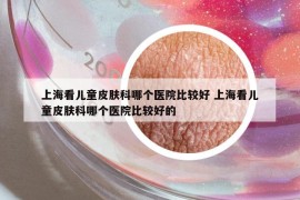 上海看兒童皮膚科哪個(gè)醫(yī)院比較好 上?？磧和つw科哪個(gè)醫(yī)院比較好的