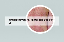 生物制劑哪個牌子好 生物制劑哪個牌子好一點(diǎn)