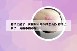 脖子上起了一片像癬不疼不癢怎么辦 脖子上長了一片癬不痛不癢
