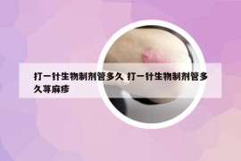 打一針生物制劑管多久 打一針生物制劑管多久蕁麻疹