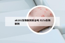 ak101生物制劑安全嗎 il17a生物制劑