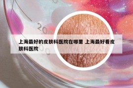 上海最好的皮膚科醫(yī)院在哪里 上海最好看皮膚科醫(yī)院
