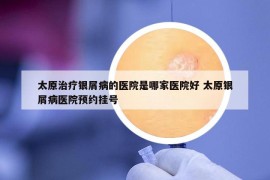 太原治療銀屑病的醫(yī)院是哪家醫(yī)院好 太原銀屑病醫(yī)院預(yù)約掛號(hào)