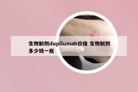 生物制劑dupilumab價格 生物制劑多少錢一瓶