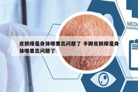 皮膚癢是身體哪里出問(wèn)題了 手腳皮膚癢是身體哪里出問(wèn)題了