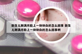 新生兒剛滿月臉上一塊塊白的怎么回事 新生兒剛滿月臉上一塊塊白的怎么回事啊