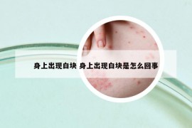 身上出現(xiàn)白塊 身上出現(xiàn)白塊是怎么回事