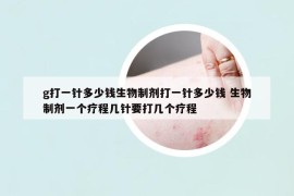 g打一針多少錢生物制劑打一針多少錢 生物制劑一個(gè)療程幾針要打幾個(gè)療程