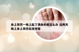 身上突然一晚上起了滿身的癬怎么辦 這兩天晚上身上突然出現(xiàn)疙瘩