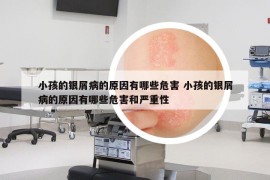 小孩的銀屑病的原因有哪些危害 小孩的銀屑病的原因有哪些危害和嚴(yán)重性