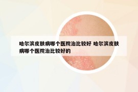 哈爾濱皮膚病哪個醫(yī)院治比較好 哈爾濱皮膚病哪個醫(yī)院治比較好的