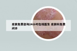 皮膚免費咨詢24小時在線醫(yī)生 皮膚科免費問診