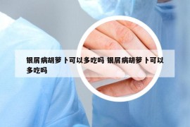 銀屑病胡蘿卜可以多吃嗎 銀屑病胡蘿卜可以多吃嗎