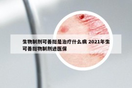 生物制劑可善挺是治療什么病 2021年生可善挺物制劑進(jìn)醫(yī)保