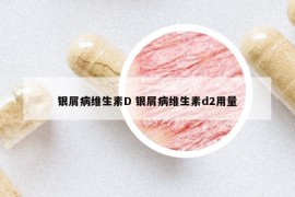 銀屑病維生素D 銀屑病維生素d2用量
