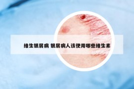 維生銀屑病 銀屑病人該使用哪些維生素