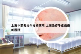 上海中藥專治牛皮癬醫(yī)院 上海治療牛皮病癬的醫(yī)院