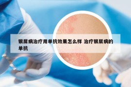 銀屑病治療用單抗效果怎么樣 治療銀屑病的單抗