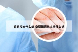 銀翹片治什么病 桑菊銀翹散主治什么病