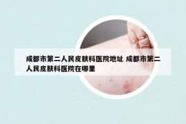 成都市第二人民皮膚科醫(yī)院地址 成都市第二人民皮膚科醫(yī)院在哪里