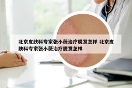 北京皮膚科專家張小薇治療脫發(fā)怎樣 北京皮膚科專家張小薇治療脫發(fā)怎樣