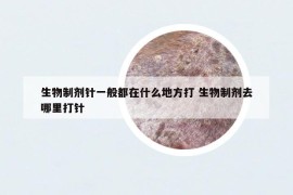 生物制劑針一般都在什么地方打 生物制劑去哪里打針